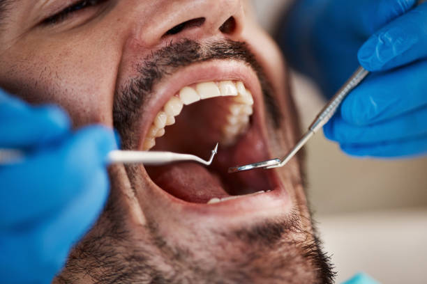 Best Emergency TMJ Treatment in Glouster, OH