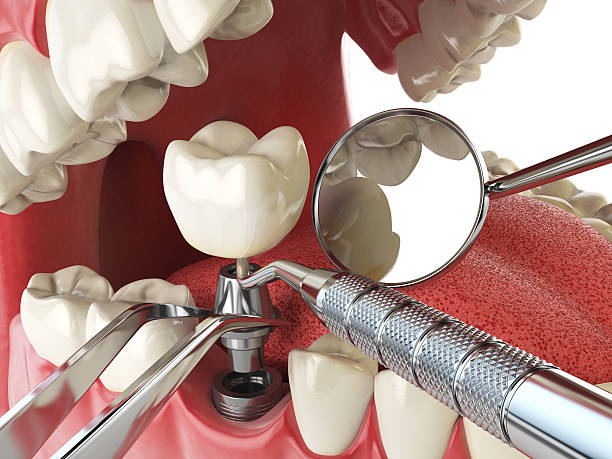 Best Cosmetic Emergency Dentistry in Glouster, OH