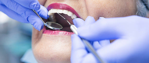 Best Emergency Tooth Extraction in Glouster, OH